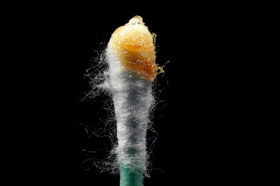 Featured image for “Earwax – Current State of Knowledge”